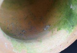 Takotsubo hart shape 1900